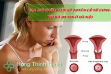 TOP 9 địa chỉ chữa viêm lộ tuyến cổ tử cung tốt và uy tín ở Hà Nội