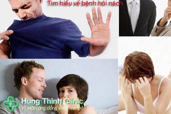 Tìm hiểu về bệnh hôi nách