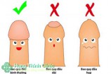 Bao quy đầu như thế nào là bình thường