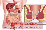TOP 11 phòng khám, địa chỉ chữa bệnh trĩ tốt nhất tại Hà Nội