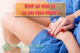 Bệnh sùi mào gà có gây ngứa không? Giải đáp từ chuyên gia