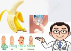 Hẹp bao quy đầu là gì? nguyên nhân và cách chữa trị hiệu quả