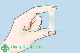 Huyết trắng màu xanh nguyên nhân là gì cách khắc phục hiệu quả