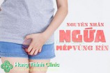 Ngứa 2 bên mép vùng kín (âm đạo) nguyên nhân cách khắc phục