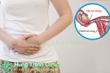 Tắc vòi trứng có thai được không? Bs Trần Thành giải đáp