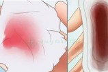 Ra máu như kinh nguyệt sau khi uống thuốc tránh thai khẩn cấp
