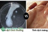 Tinh trùng loãng là như thế nào có sao không? cách chữa trị
