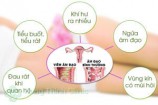 TOP 6 triệu chứng bệnh phụ khoa thường gặp nhất ở nữ giới