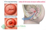 Viêm cổ tử cung có mang thai được không, có nguy hiểm không?