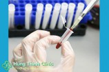 Phương pháp xét nghiệm bệnh giang mai sau bao lâu là chính xác