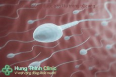 Tinh trùng sống được bao lâu trong tử cung