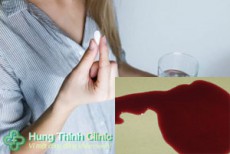 Sau khi uống thuốc phá thai bao lâu thì ra máu? có nguy hiểm không