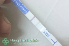 Hình ảnh que thử thai 2 vạch mờ có thai không thưa Bác Sĩ?