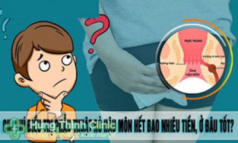 Chi phí phẫu thuật rò hậu môn hết bao nhiêu tiền giá năm 2025